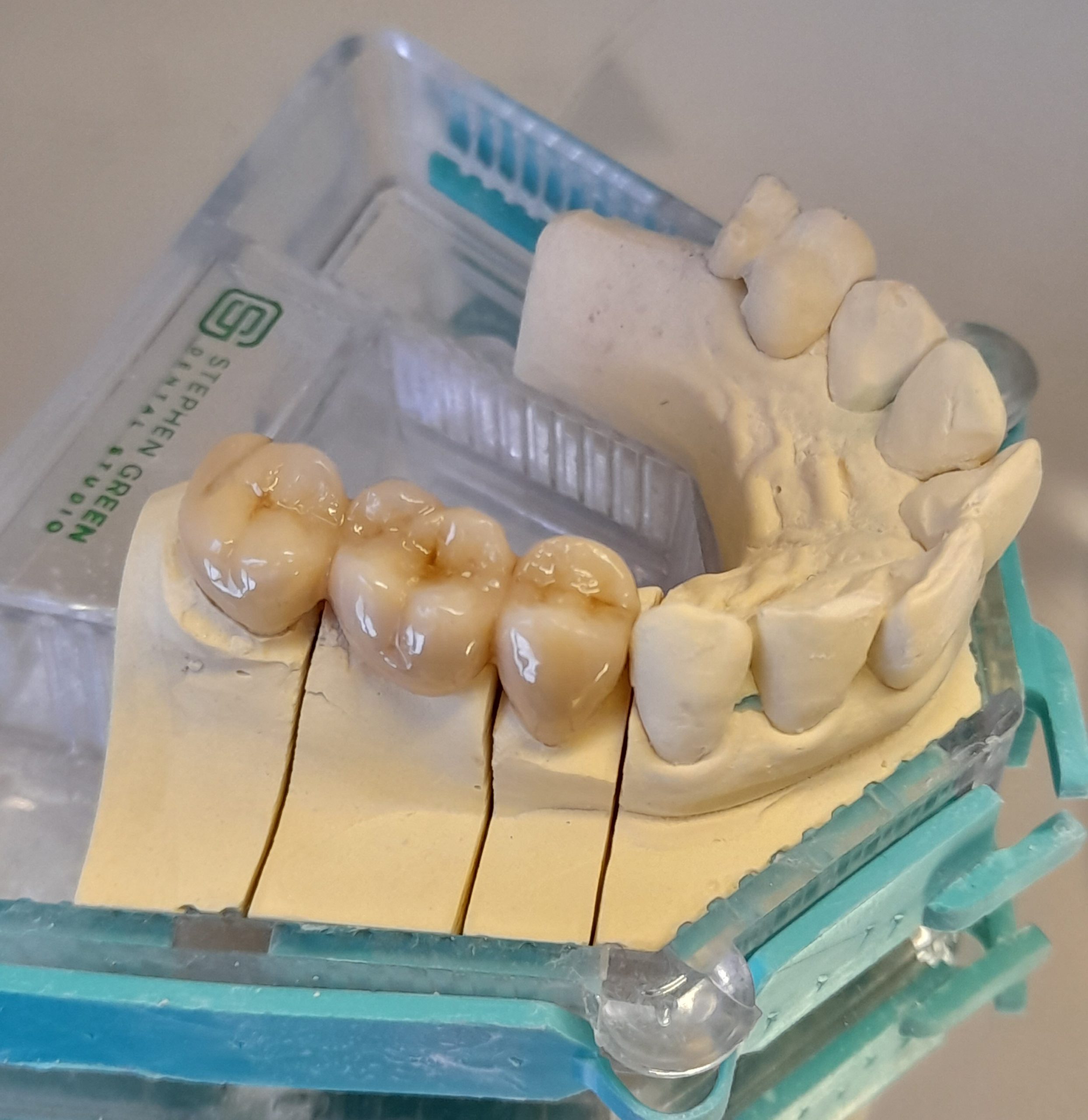 Designed to blend with the natural appearance of patients' teeth